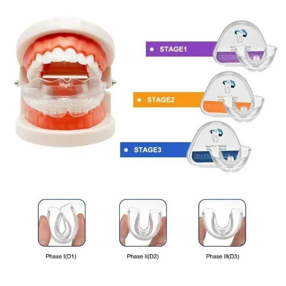 Teeth Whitening For Braces - Penyangga Gigi Ortodontik Pelurus Gigi Alat