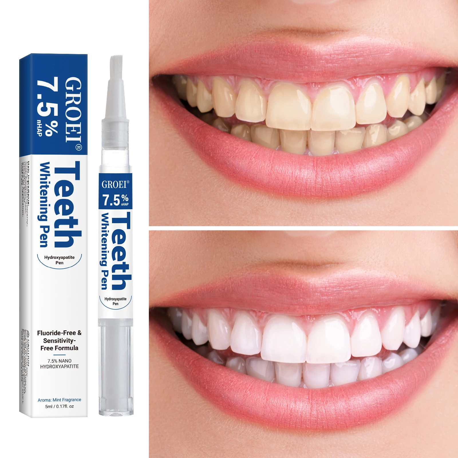 Pena Pemutih Gigi Hidroksiapat - Teeth Whitening Groupon ulasan dan harga