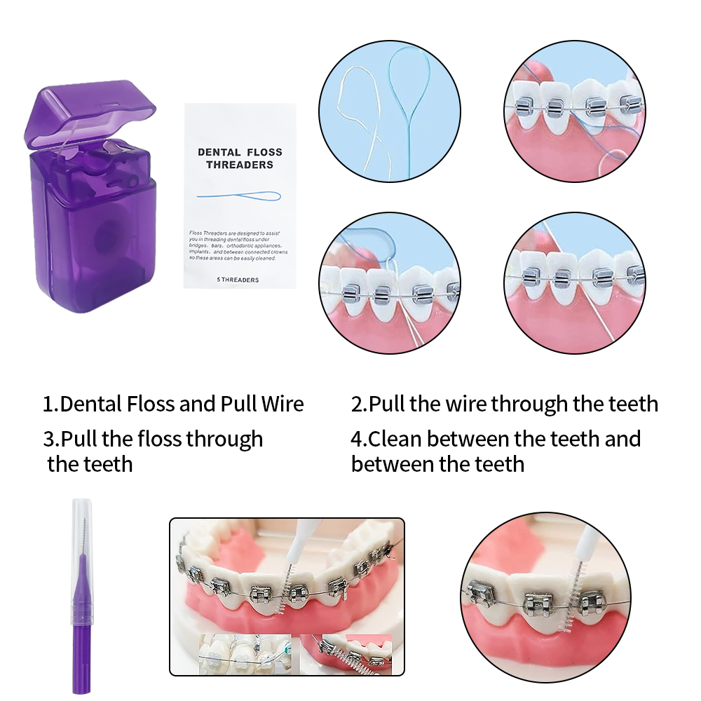 Kit sikat gigi, perawatan gigi - Teeth Whitening For Braces ulasan dan harga