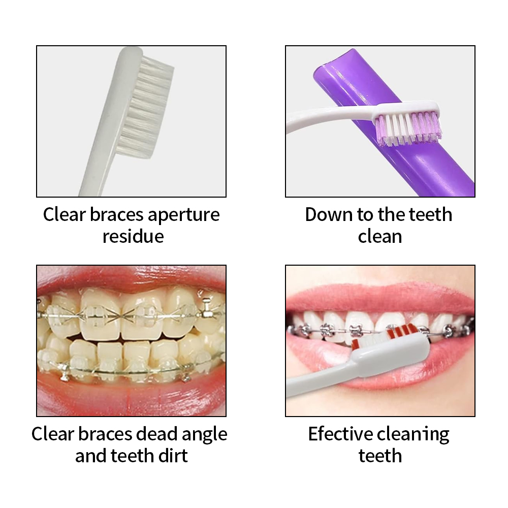 Kit sikat gigi, perawatan gigi - Teeth Whitening For Braces ulasan dan harga