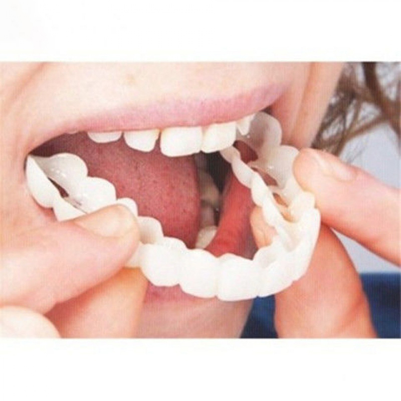 Penutup Gigi Palsu Cocok Sempu - Teeth Whitening For Braces ulasan dan harga