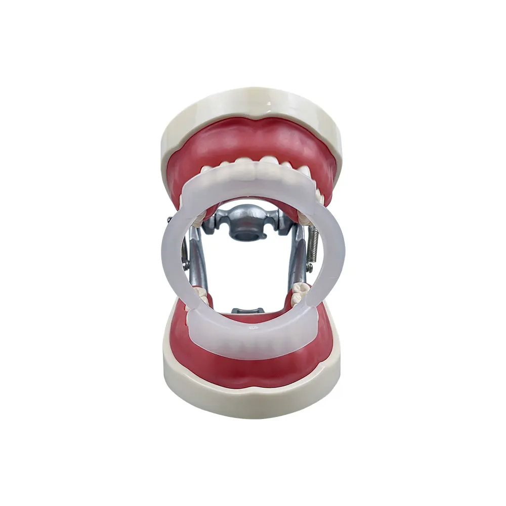 100pcs/bag Retraktor Bibir & P - Teeth Whitening For Braces ulasan dan harga