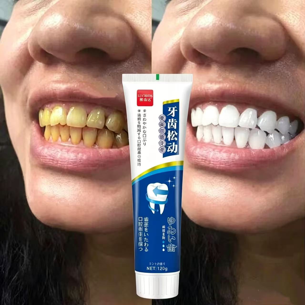Pasta Gigi Impor Jepang untuk  - Teeth Whitening Japan ulasan dan harga