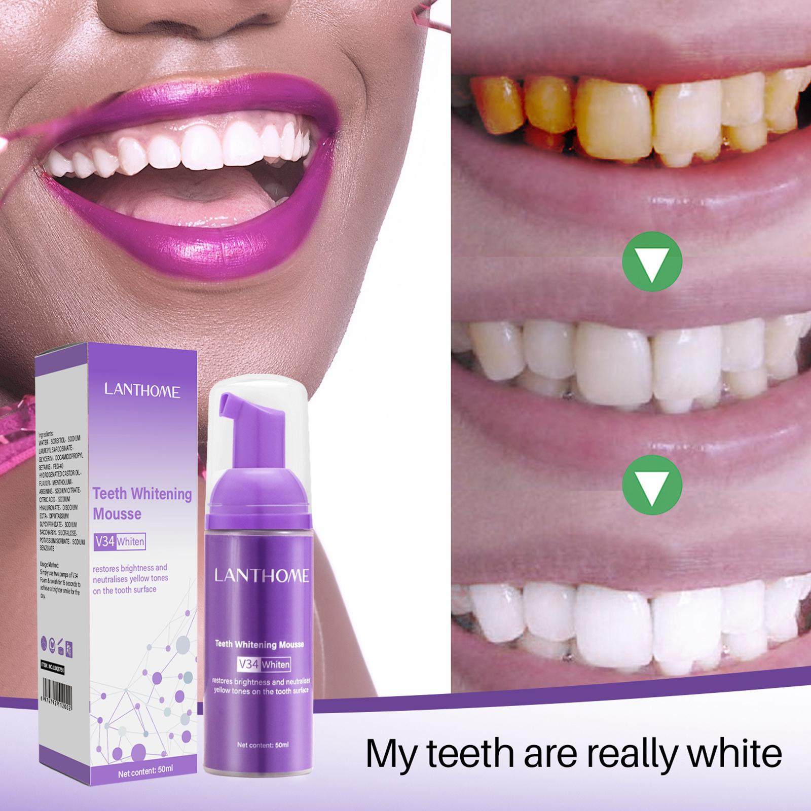 V34 pasta gigi Mousse efektif  - Teeth Whitening Best ulasan dan harga