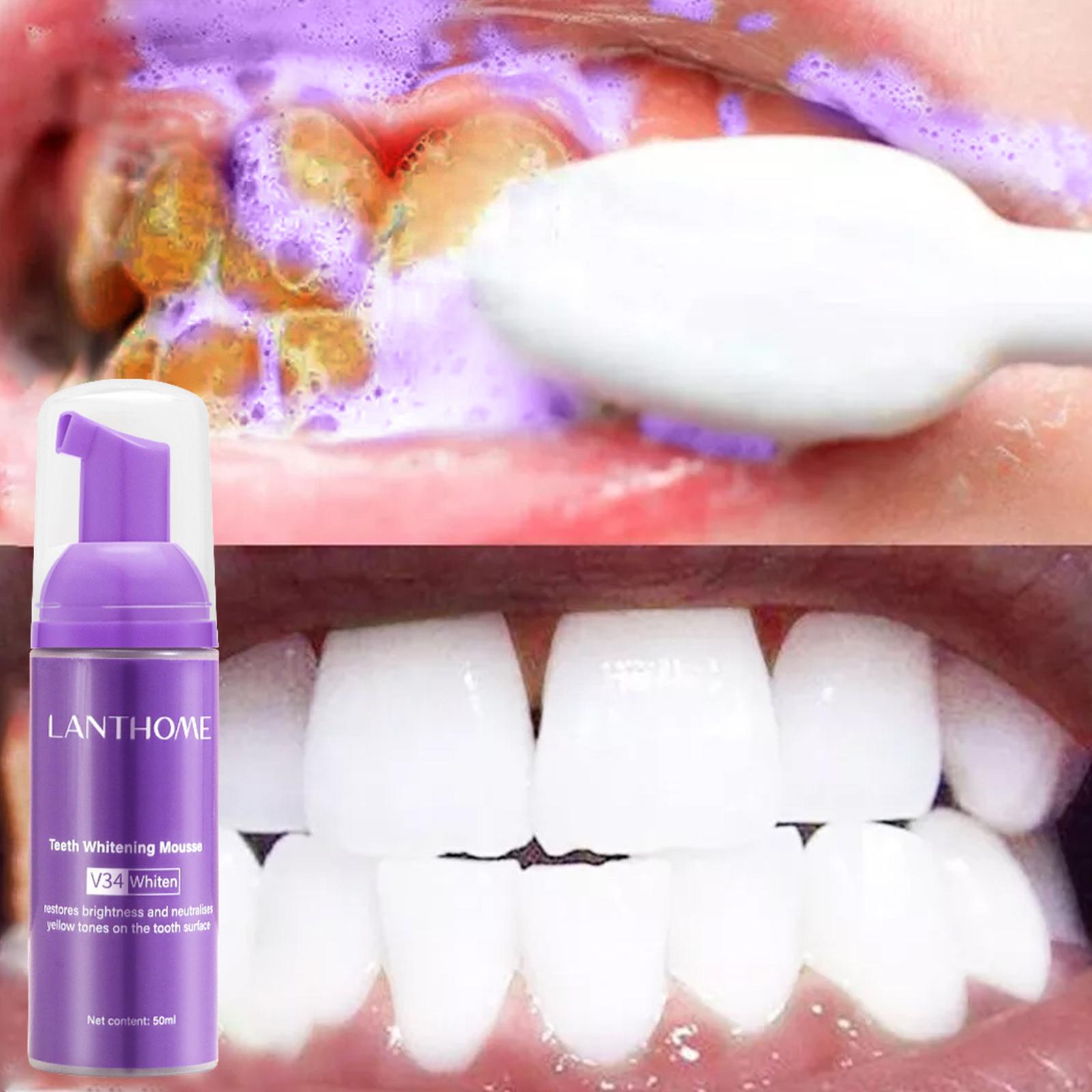 V34 pasta gigi Mousse efektif  - Teeth Whitening Best ulasan dan harga