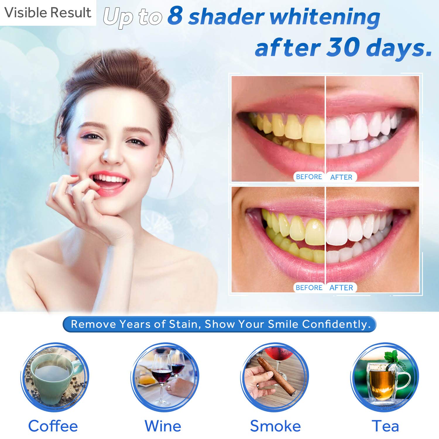 Gel Pemutih Gigi Isi Ulang Syr - Teeth Whitening Groupon ulasan dan harga