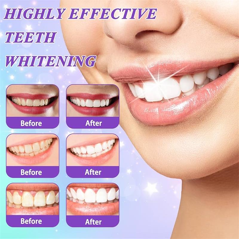 Pasta Gigi Pemutih Gigi Ungu 9 - Teeth Whitening That Works ulasan dan harga