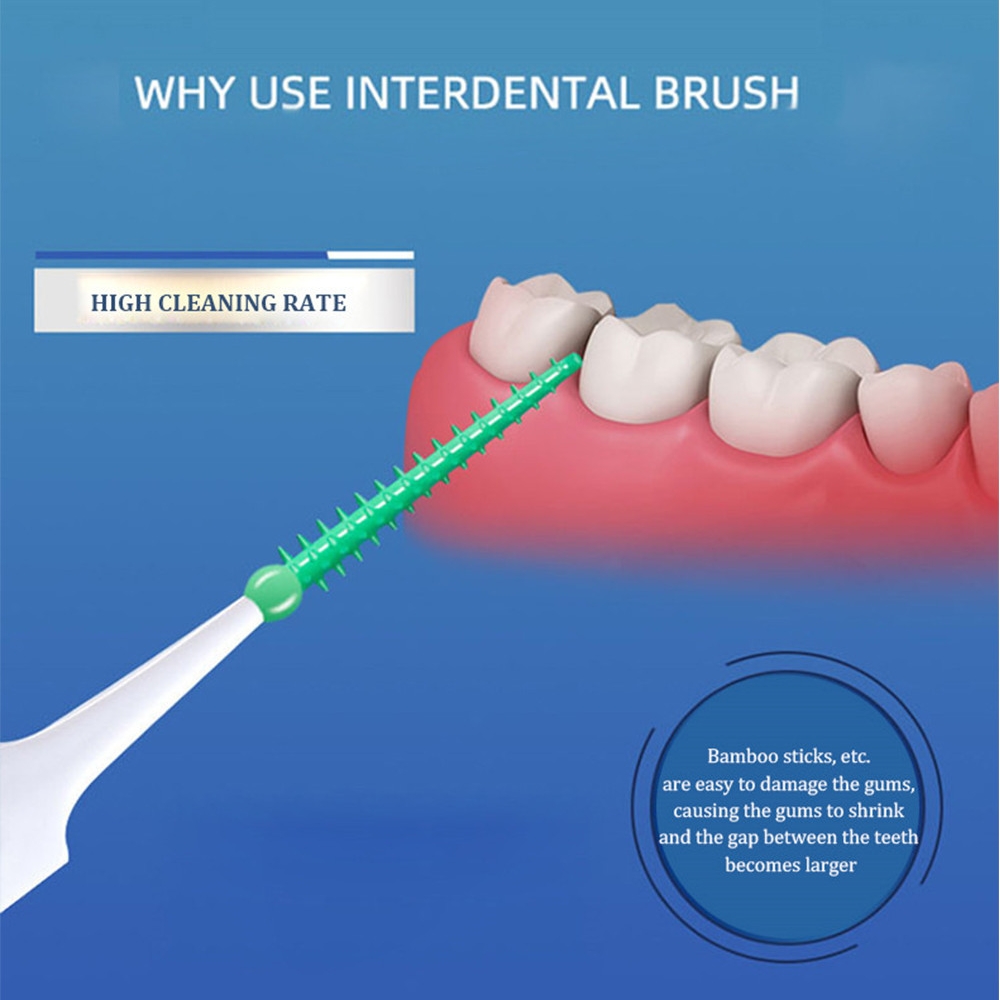 40 ~ 150 Buah Sikat Interdenta - Teeth Whitening For Braces ulasan dan harga