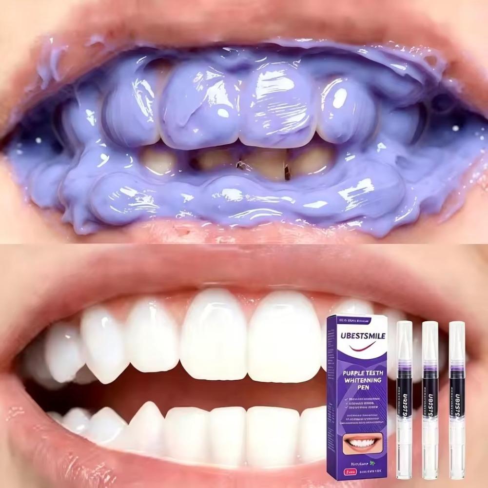 Pena Pemutih Gigi Ungu V34, Pe - Teeth Whitening Gel Pen ulasan dan harga