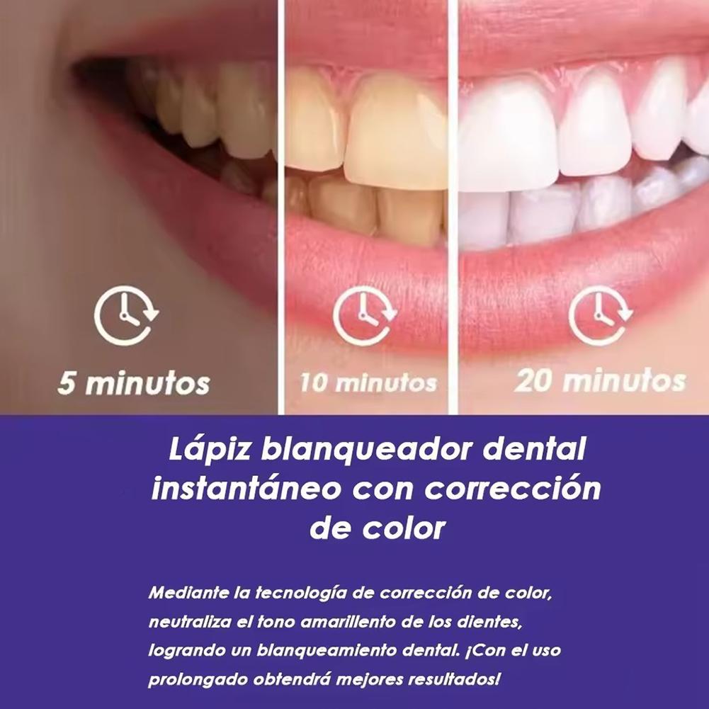Pena Pemutih Gigi Ungu V34, Pe - Teeth Whitening Gel Pen ulasan dan harga