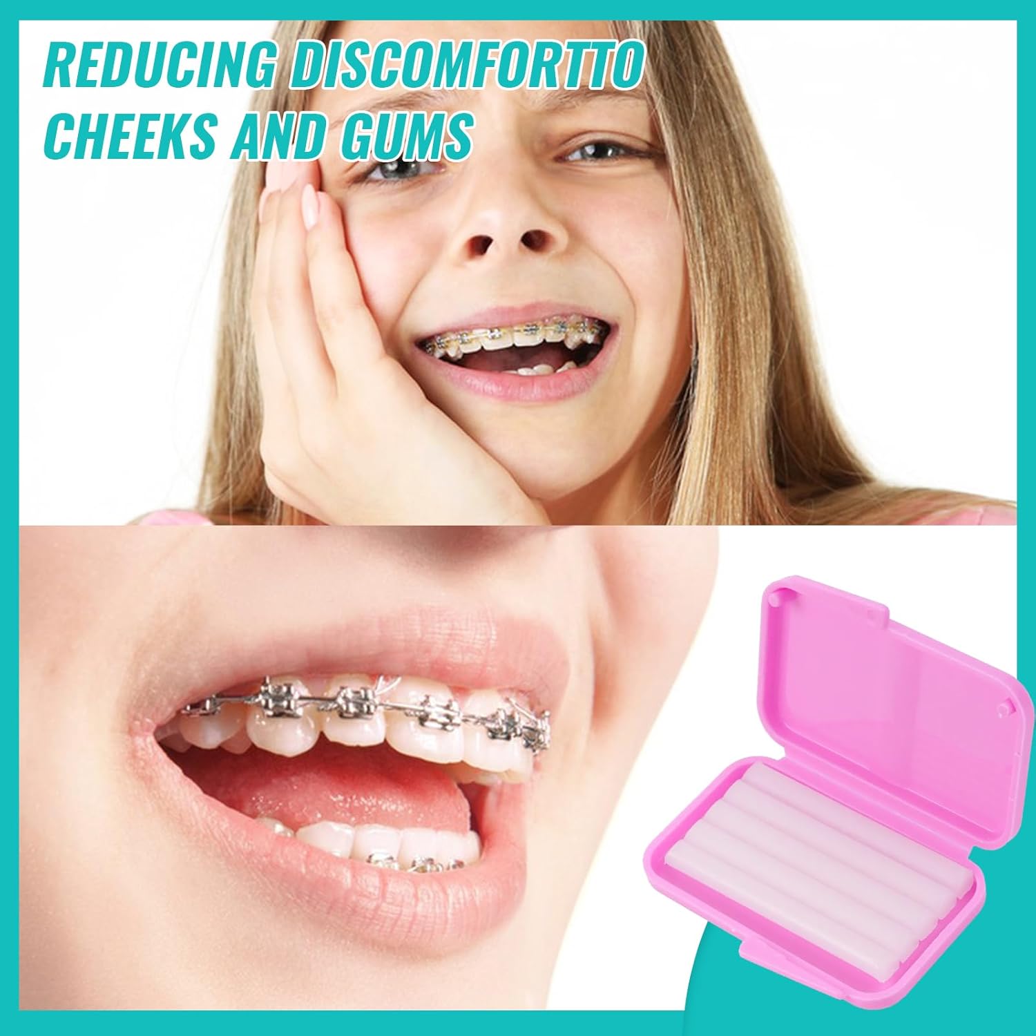 10 Kotak Lilin Ortodontik Gigi - Teeth Whitening For Braces ulasan dan harga