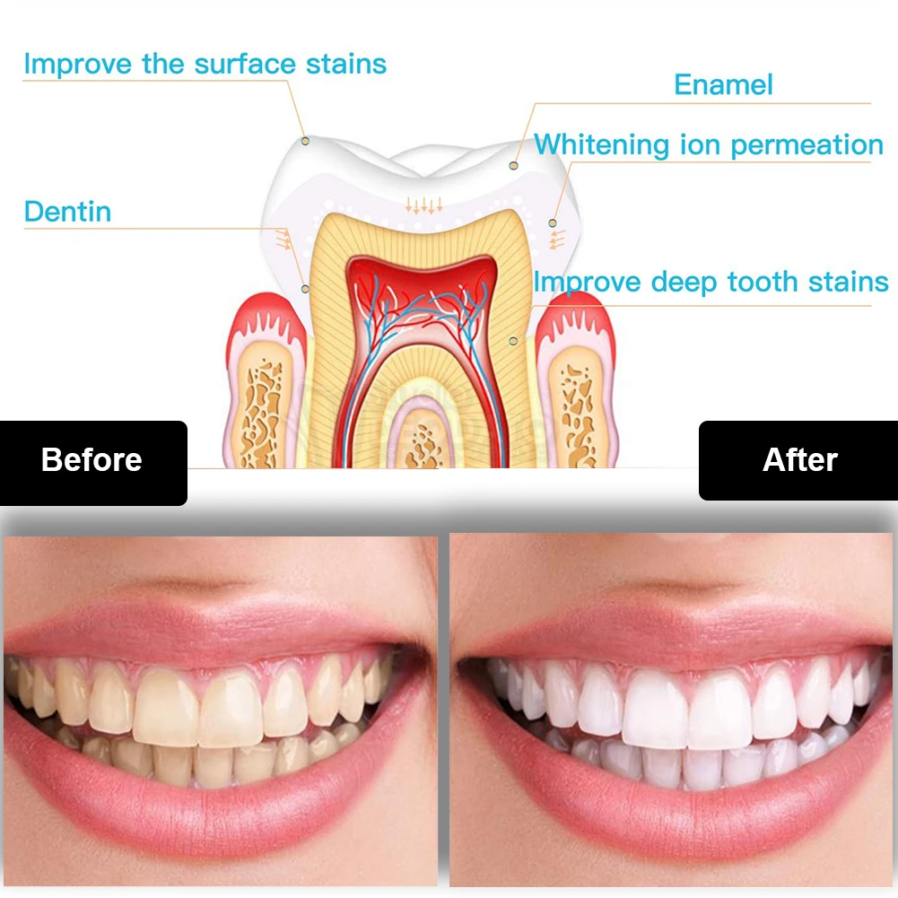 Kit pemutih gigi Mini 16 LED c - Teeth Whitening That Works ulasan dan harga