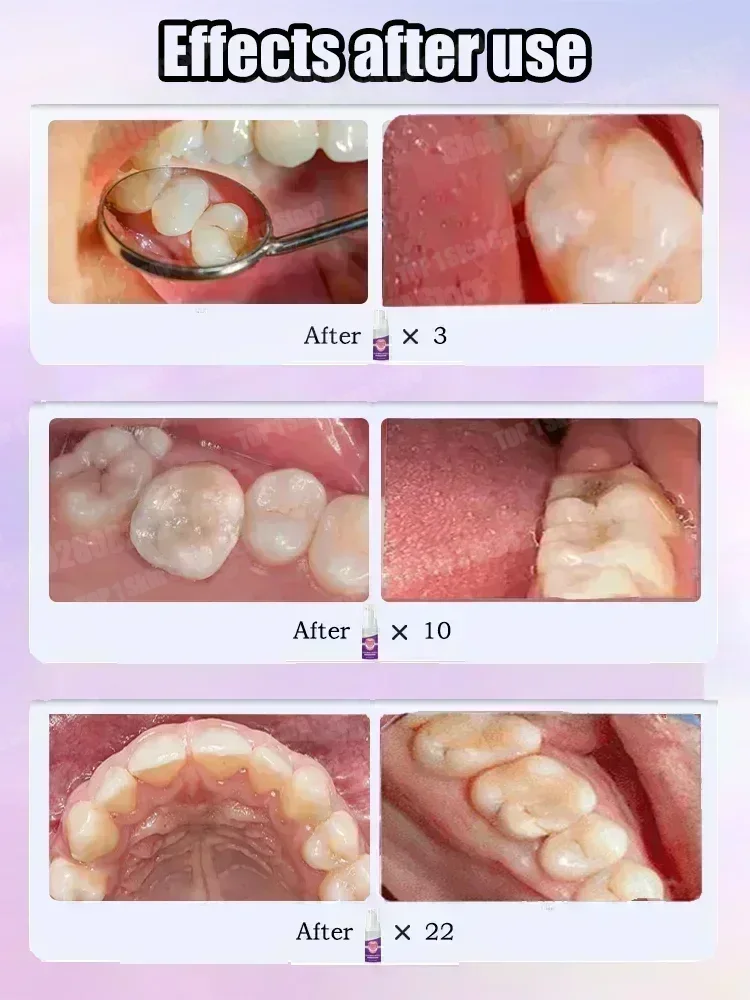 Penjualan Terlaris Terlaris, P - Teeth Whitening Best ulasan dan harga