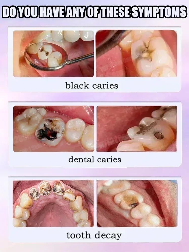 Penjualan Terlaris Terlaris, P - Teeth Whitening Best ulasan dan harga