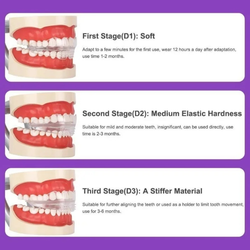 Penyangga Gigi Ortodontik Pelu - Teeth Whitening For Braces ulasan dan harga