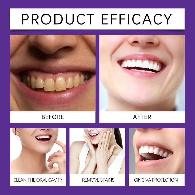 Bubuk Mineral Restorasi Gigi U - Teeth Whitening That Works ulasan dan harga