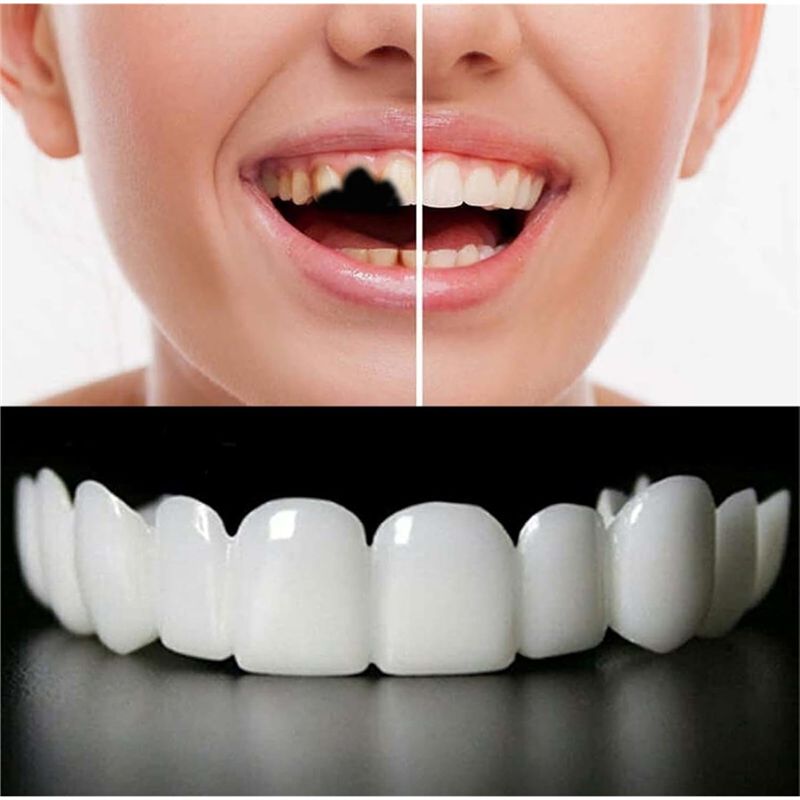 [BARU!ABMK】 2 Pasang, Kembalik - Teeth Whitening For Braces ulasan dan harga